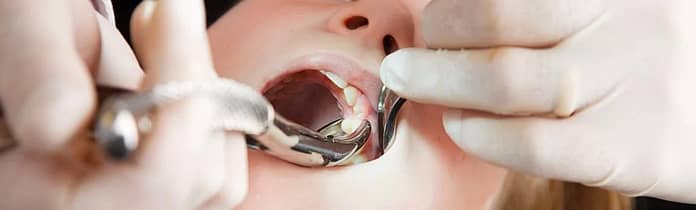 chirurgie-dentara.jpg